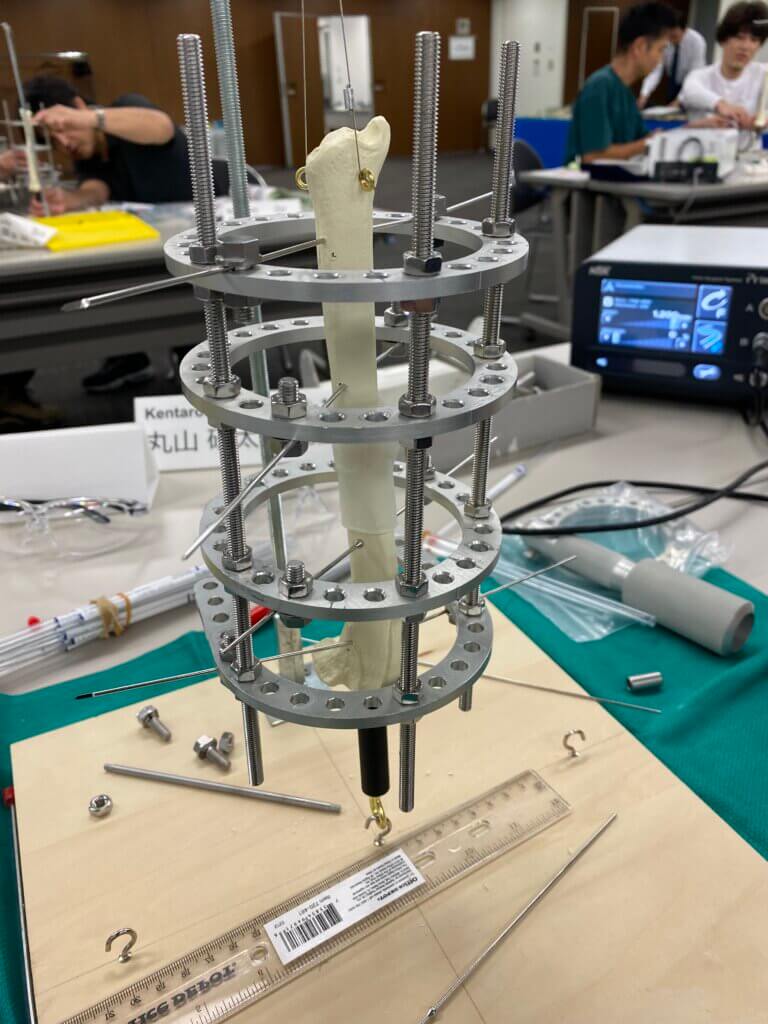 整形外科の実習　創外固定